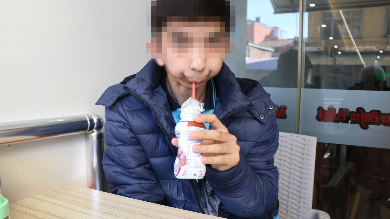 Alt çenesi yok, dişleri üst damağında: Ameliyat için yardım bekliyor