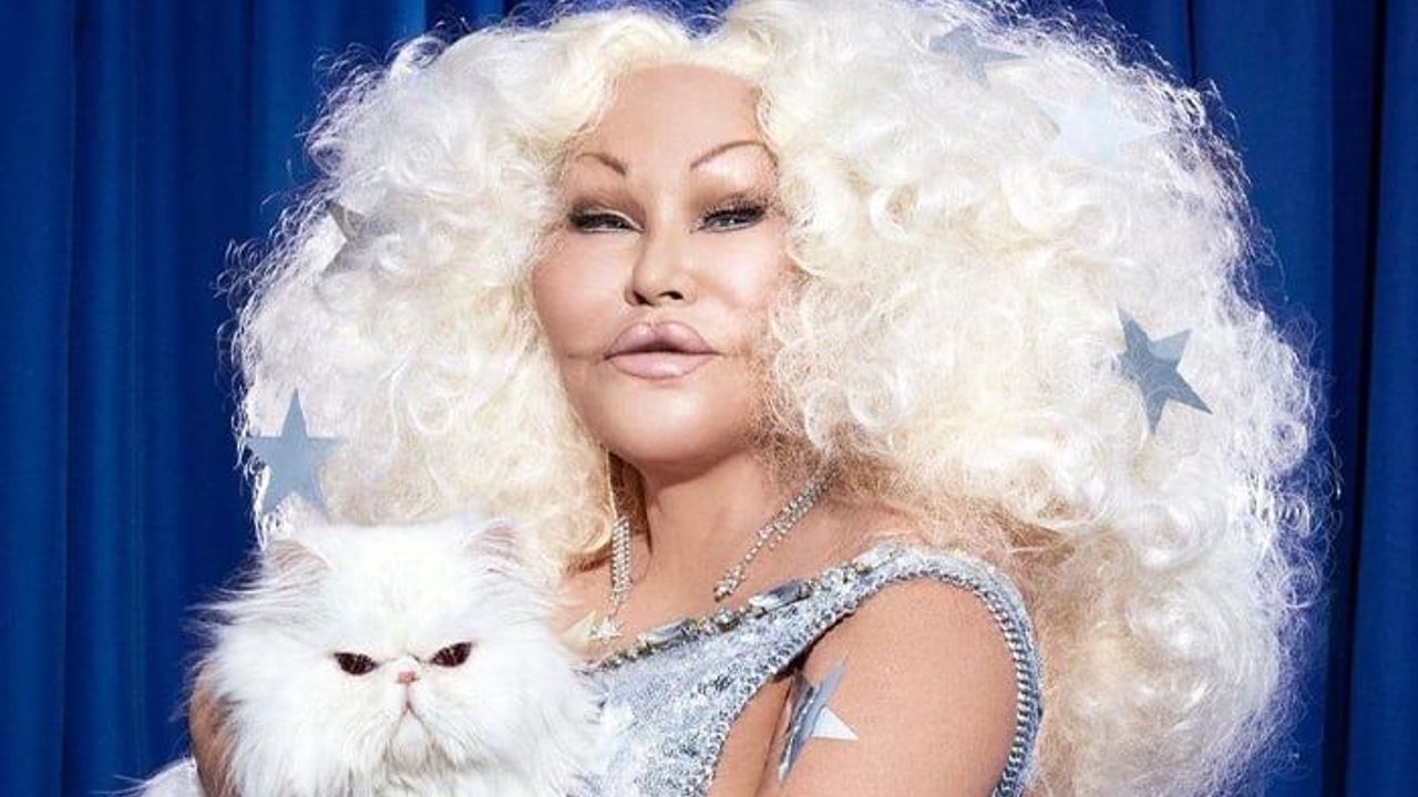 "Kedi Kadın" Jocelyn Wildenstein kimdir? Neden öldü?