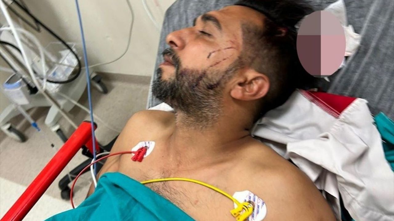 Döner ustasının başına yorgun mermi isabet etti: Ölümden döndü