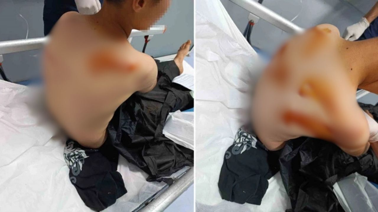 17 yaşındaki genç 11 yaşındaki çocuğu sopayla darbetti