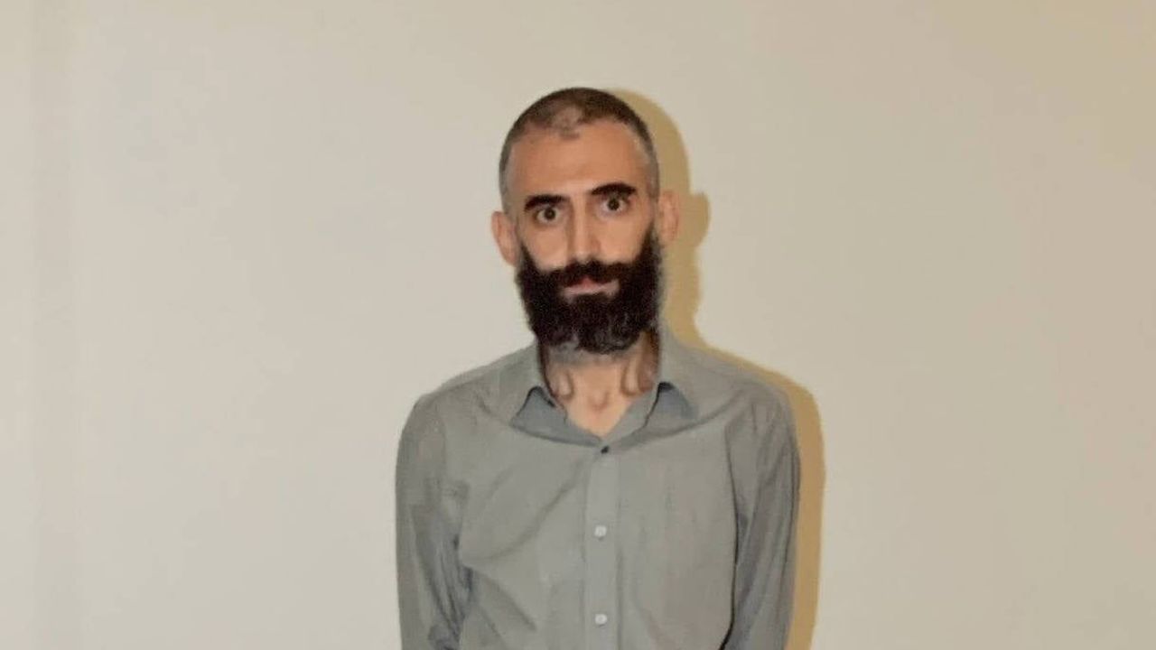 Gürkan Türkoğlu kimdir? Gürkan Türkoğlu neden öldü, nereli, ne iş yapıyor, neden cezaevindeydi?