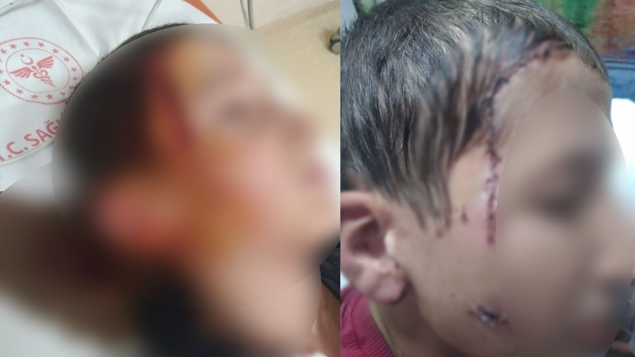 Köpek saldırısında yaralanmıştı! Aileye ödenecek tazminat belli oldu