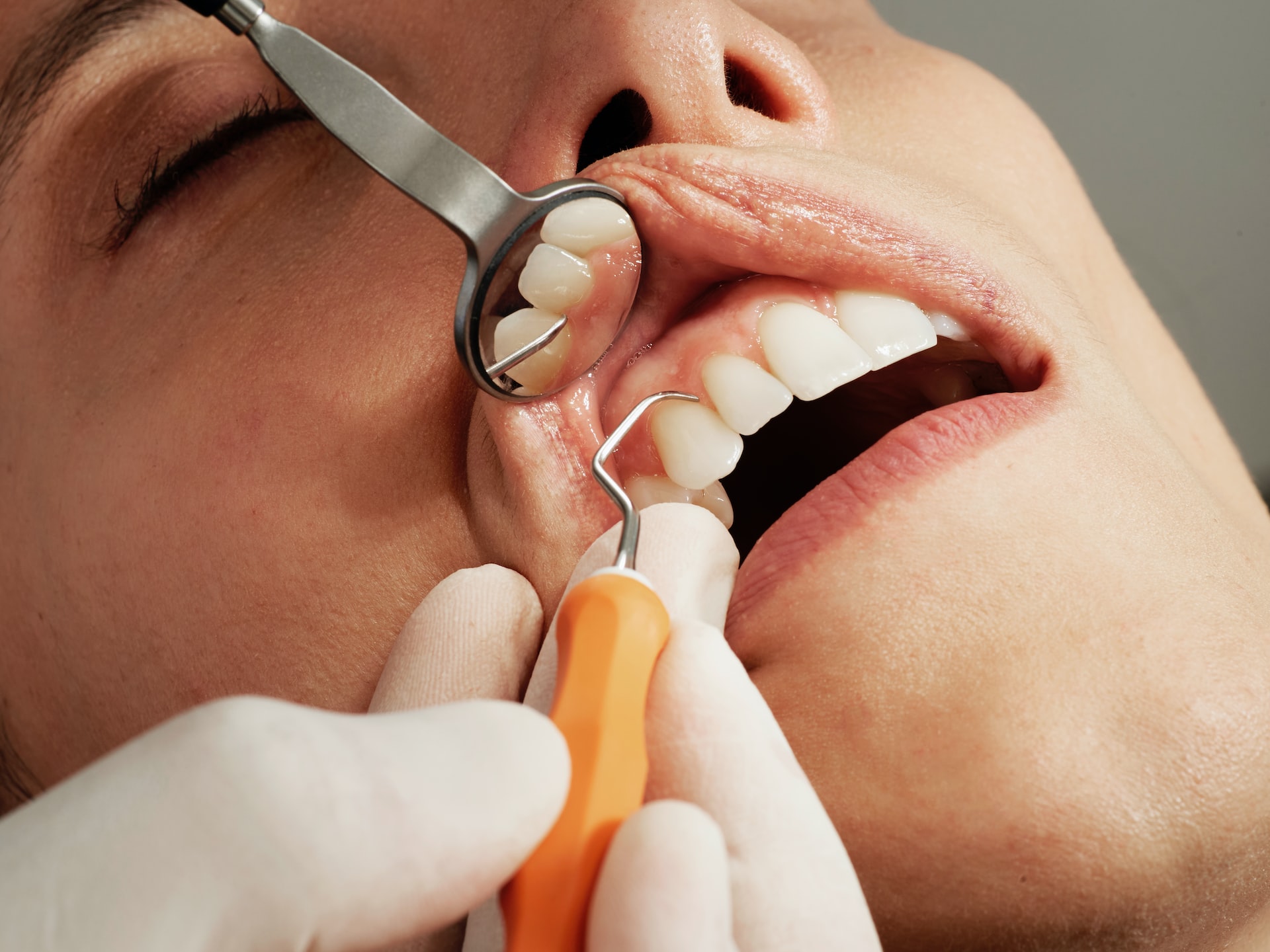 Dentin hassasiyetine dikkat  (1)