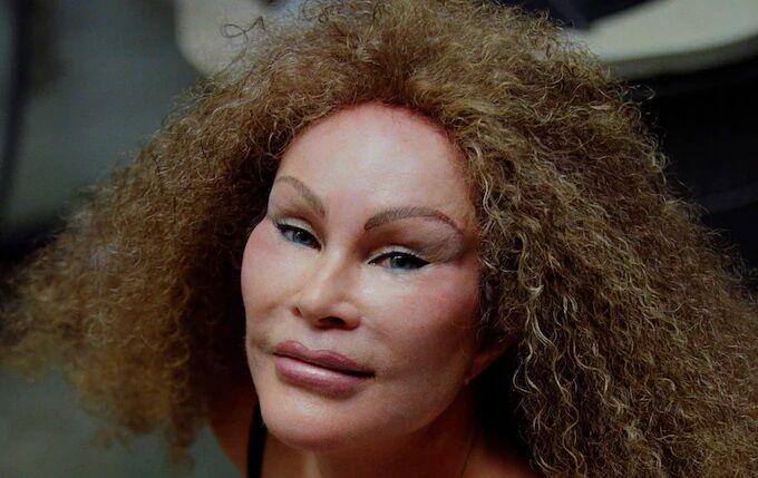 Jocelyn Wildenstein Kimdir
