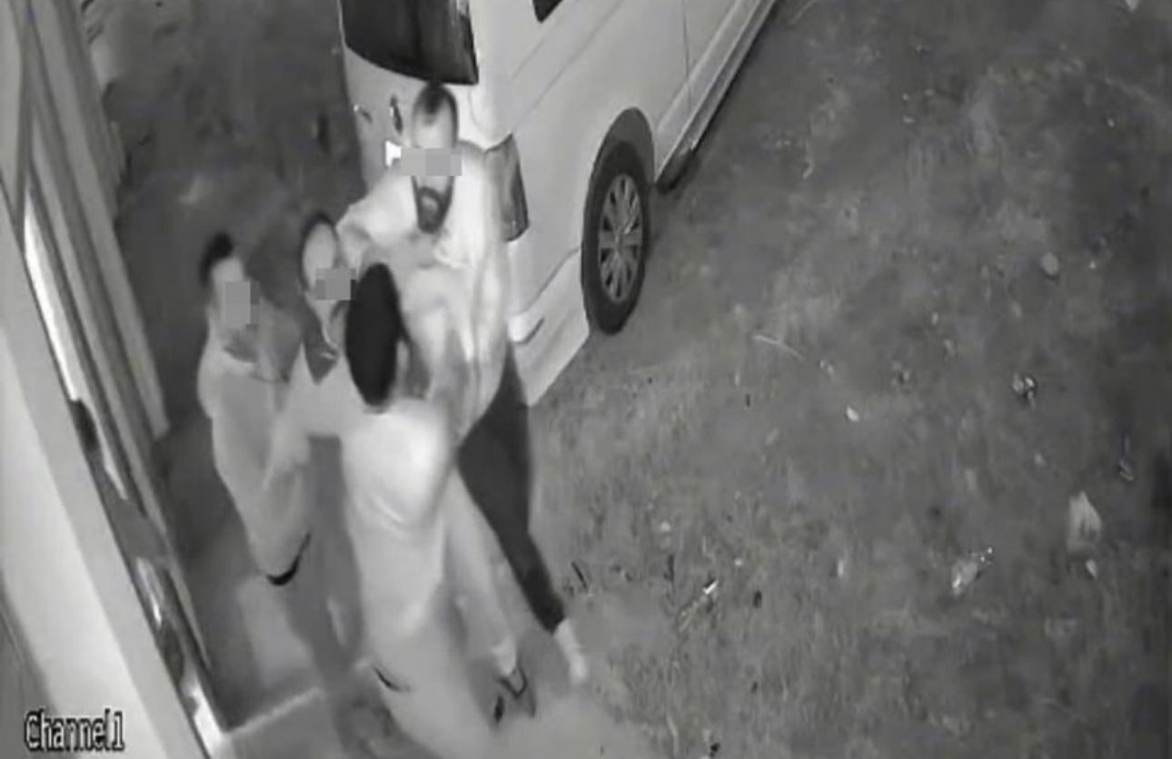 Boşanma Kavgası Kanlı Bitti Sanatçıya Aile Şiddeti (3)