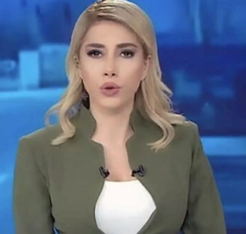 Ela Rümeysa Cebeci Estetiksiz (2)