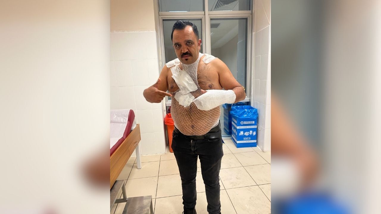 Şov Yapayım Derken Kendini Yaktı (4)