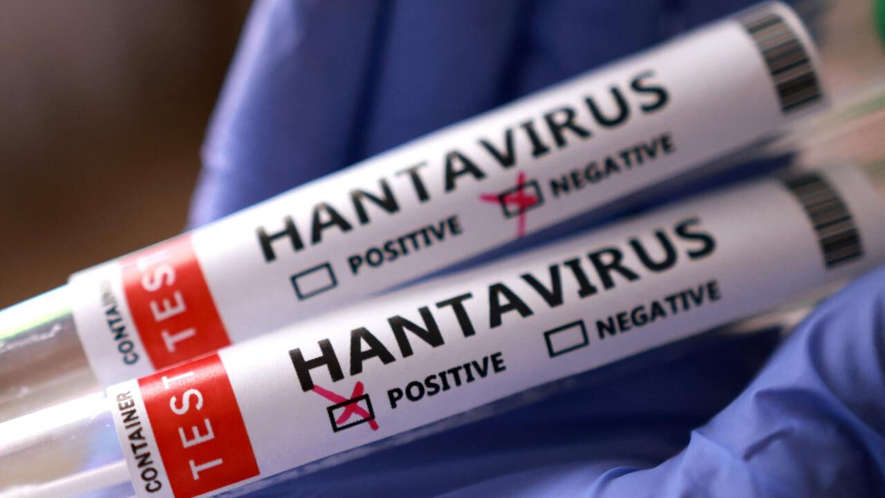 Hantavirus