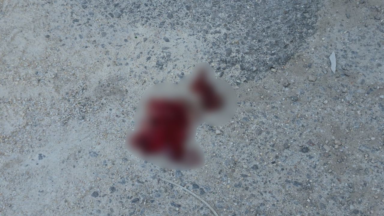 9 Metre Yüksekten Düştü (1)